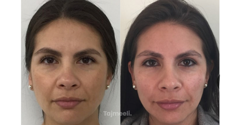 تجربتي مع عرق السوس للتبييض | خلطات طبيعية والنتائج